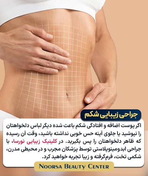 جراحی زیبایی شکم یا ابدومینوپلاستی