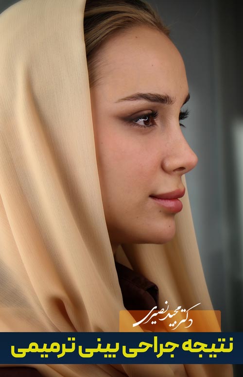 نتیجه جراحی بینی ترمیمی