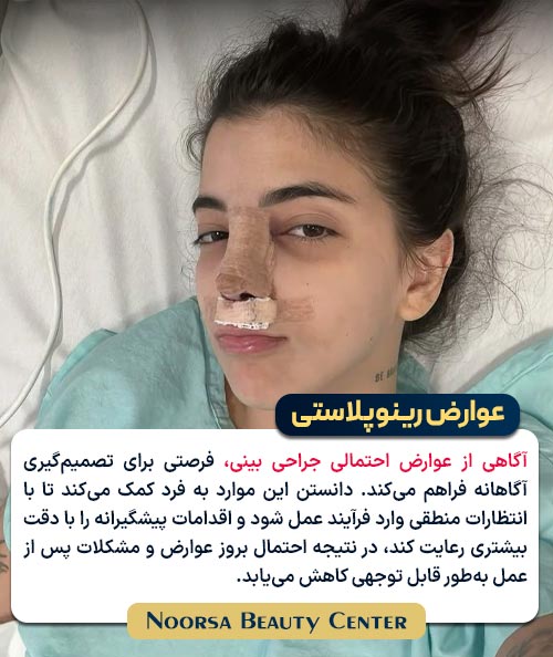 اهمییت آگاهی از عوارض رینوپلاستی