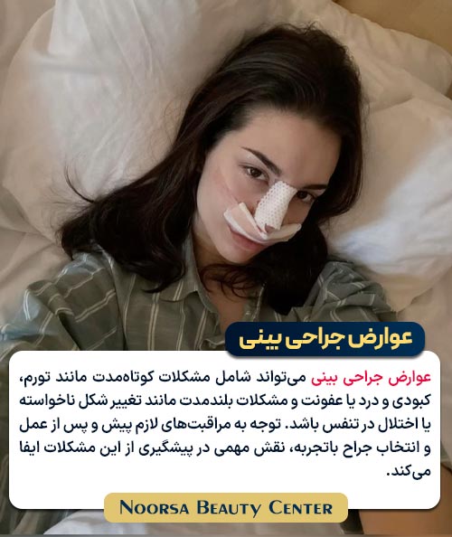 عوارض جراحی بینی