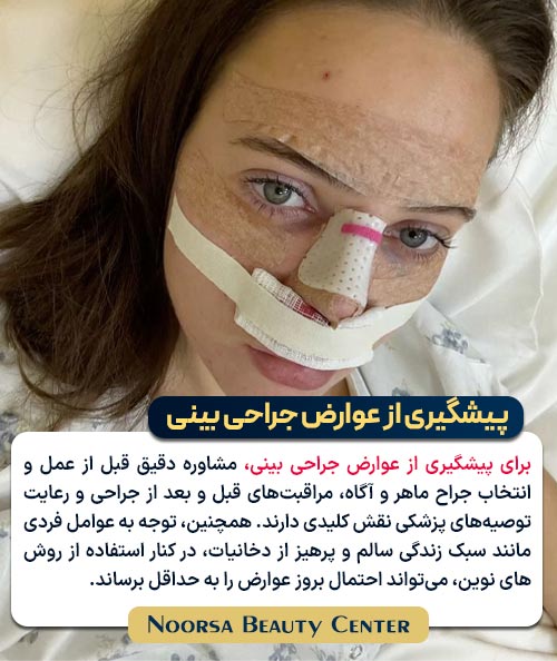 پیشگیری از عوارض جراحی بینی