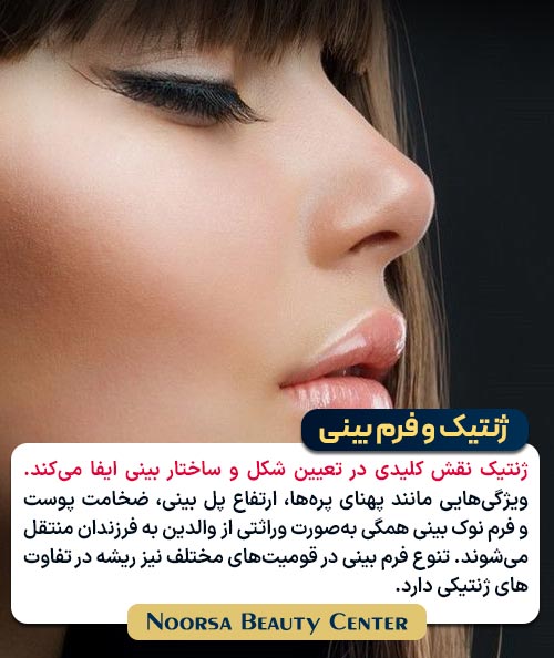 ژنتیک و فرم بینی