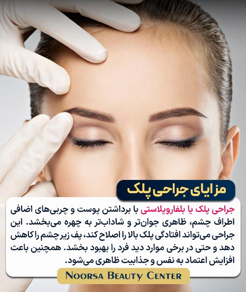 مزایای جراحی پلک
