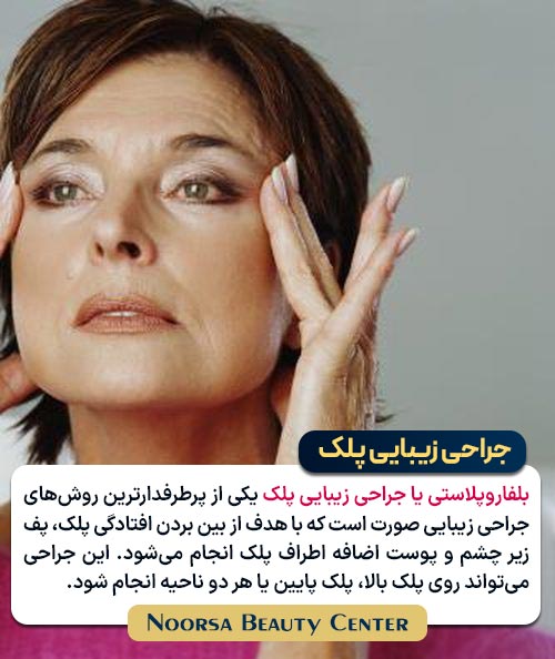 بلفاروپلاستی چیست