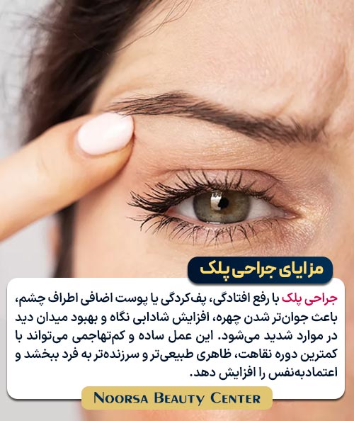 مزایای جراحی پلک