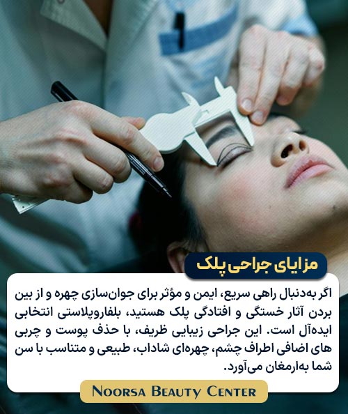 بلفاروپلاستی