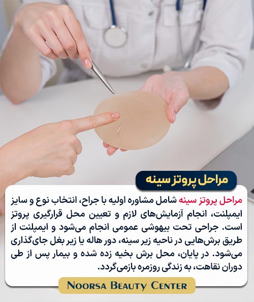 مراحل پروتز سینه