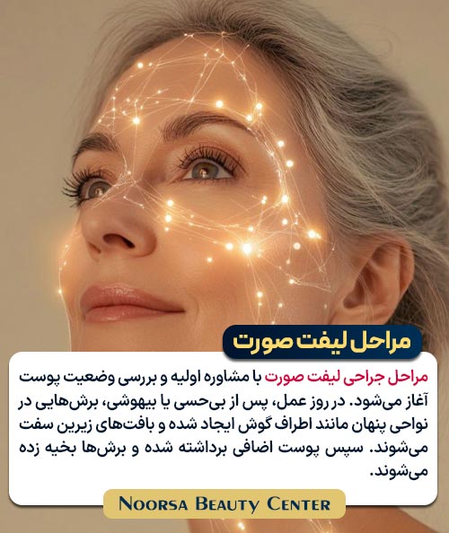 مراحل لیفت صورت