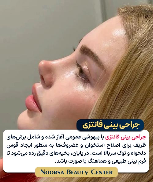 مراحل جراحی بینی فانتزی