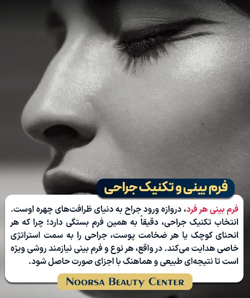 فرم بینی و تکنیک جراحی