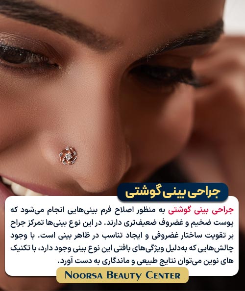 جراحی بینی گوشتی