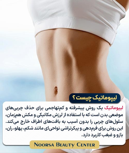 لیپوماتیک چیست ؟