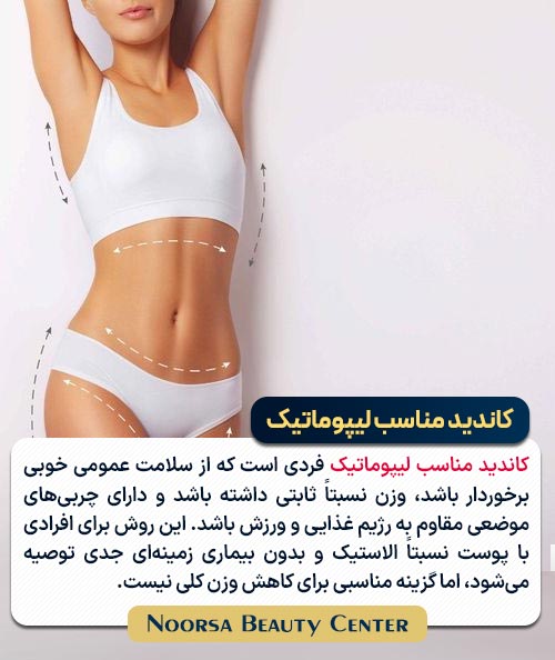 کاندید مناسب عمل لیپوماتیک