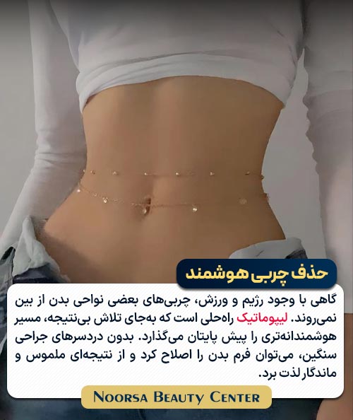 حذف چربی هوشمند با لیپوماتیک