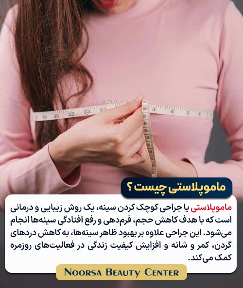 ماموپلاستی چیست