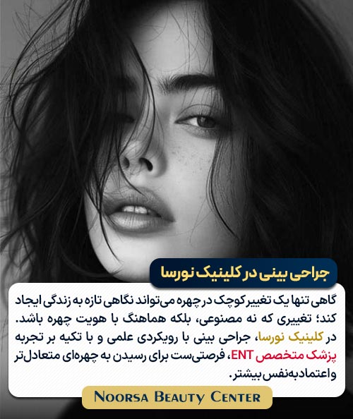 جراحی بینی در کلینیک نورسا