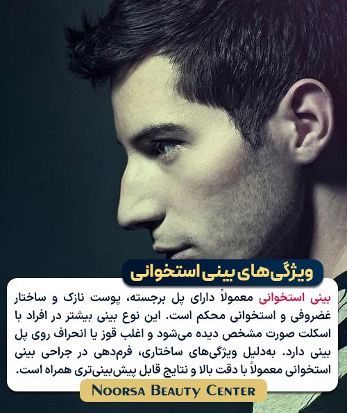 ویژگی های بینی استخوانی