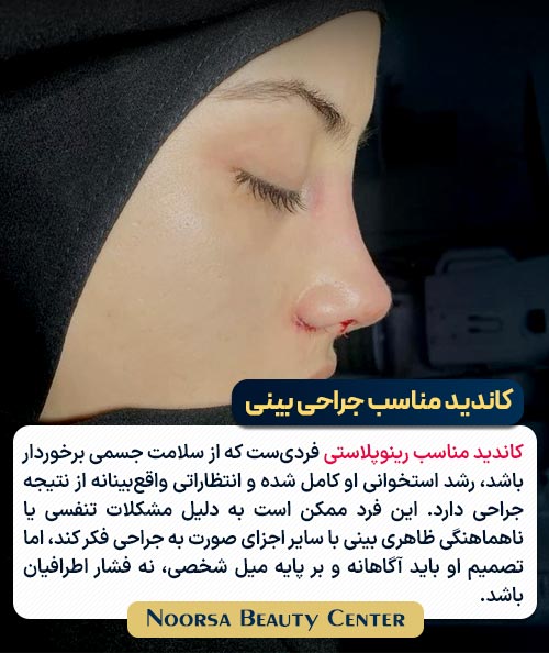 کاندید مناسب جراحی بینی