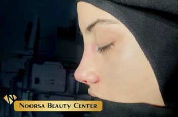 عوارض جراحی بینی