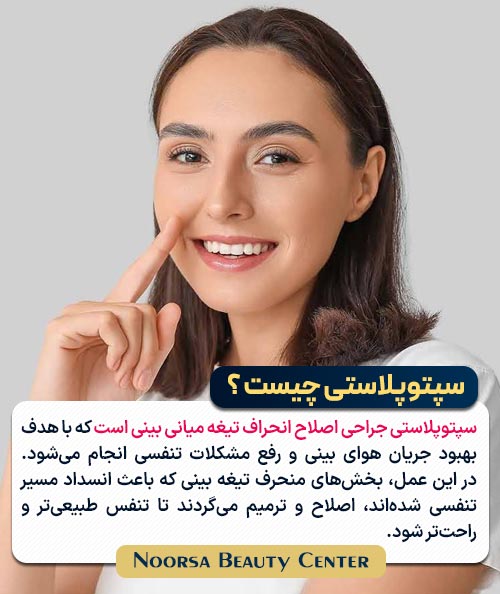 سپتوپلاستی