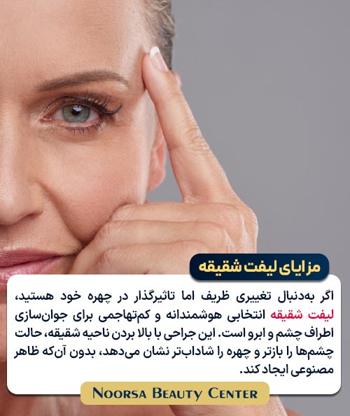 مزایای لیفت شقیقه