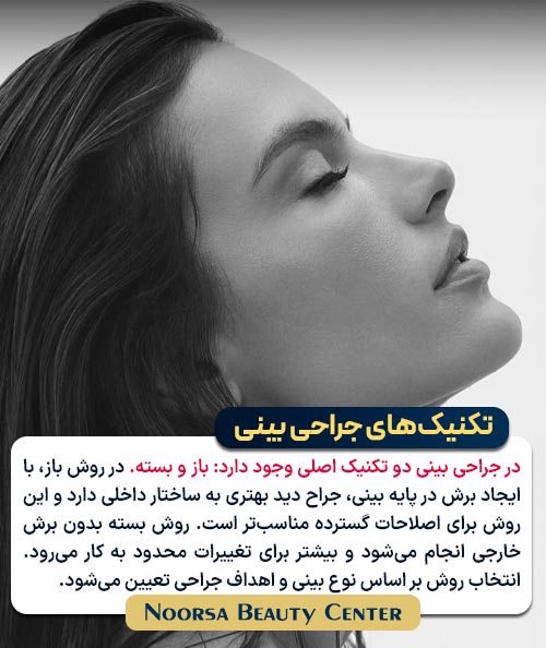 تکنیک های جراحی بینی