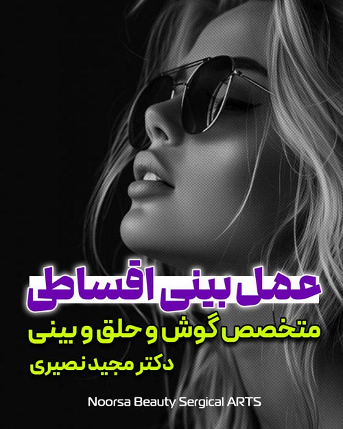 جراحی بینی اقساطی