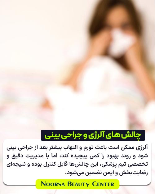 چالش جراحی بینی برای بیماران مبتلا به آلرژی 