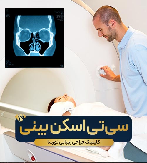 سی تی اسکن بینی