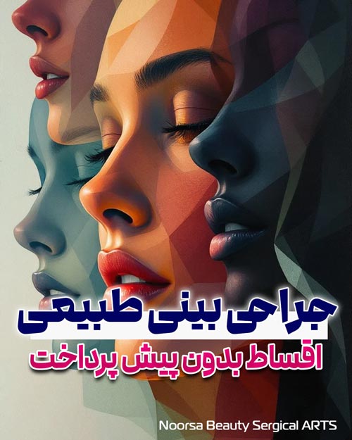 جراحی بینی اقساطی