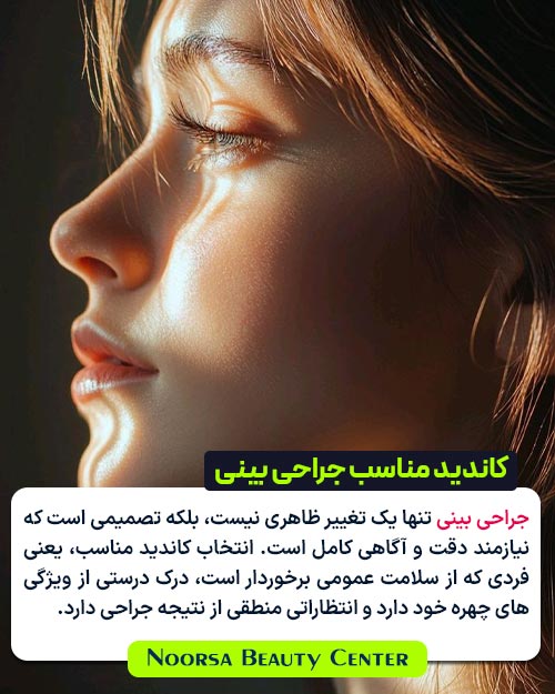 کاندید مناسب جراحی بینی