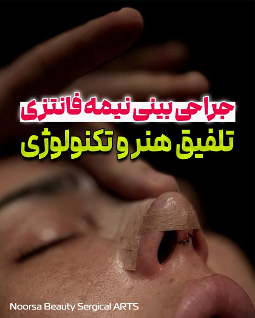 جراحی بینی نیمه فانتزی