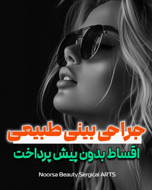 جراحی بینی طبیعی اقساطی