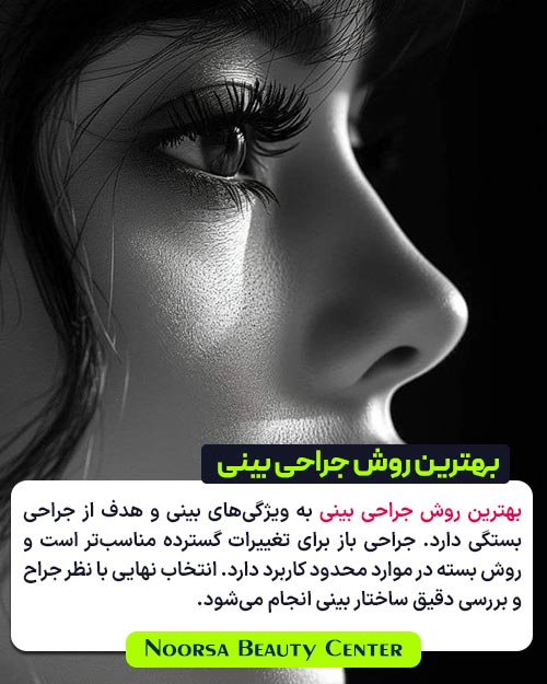 بهترین روش جراحی بینی
