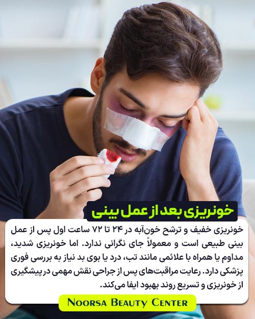 خونریزی بعد از عمل بینی