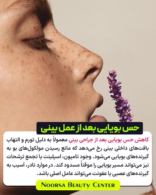 دلایل کاهش حس بویایی بعد از عمل بینی