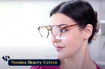 عینک بعد از جراحی بینی