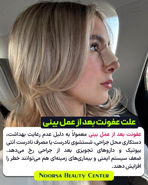 عکس نوشت : دلایل ایجاد عفونت بعد از جراحی بینی