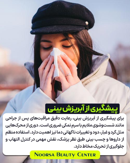 پیشگیری از آبریزش بینی بعد از عمل