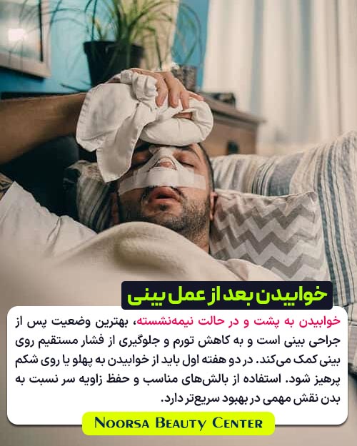 نحوه خوابیدن بعد از عمل بینی