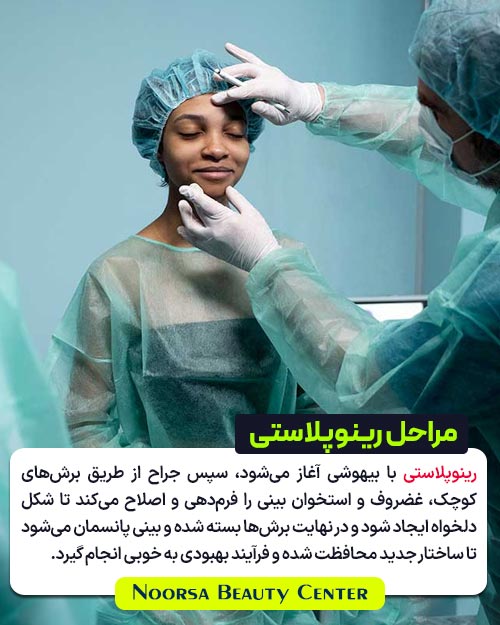 مراحل عمل رینوپلاستی به همراه عکس در اتاق عمل