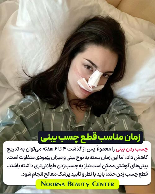 زمان مناسب چسب زدن به بینی