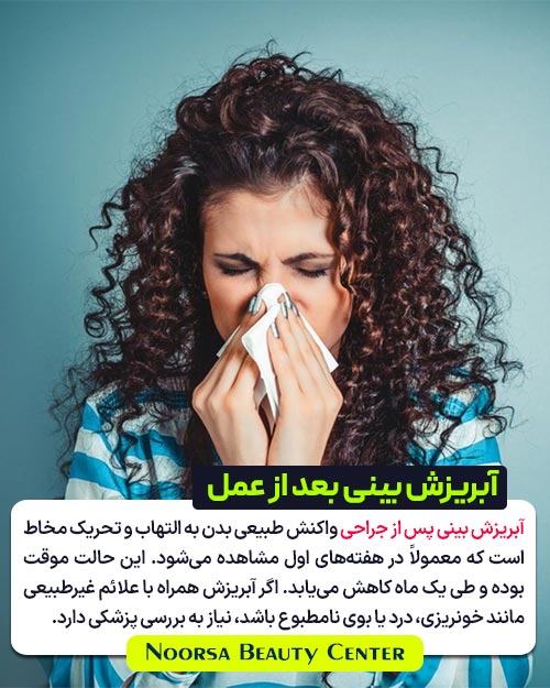 دلیل و عوارض آبریزش بینی بعد از عمل بینی