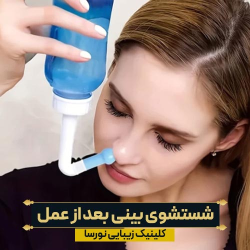 نحوه شستشوی بینی بعد از عمل