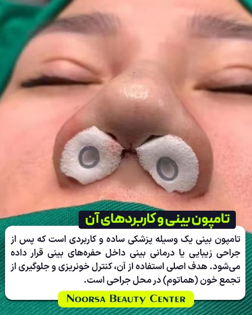 تامپون بینی و کاربردهای آن