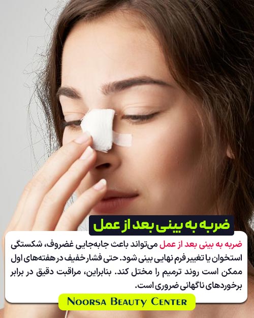ضربه به بینی بعد از عمل جراحی