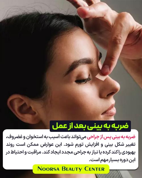 عوارض ضربه شدید به بینی بعد از عمل