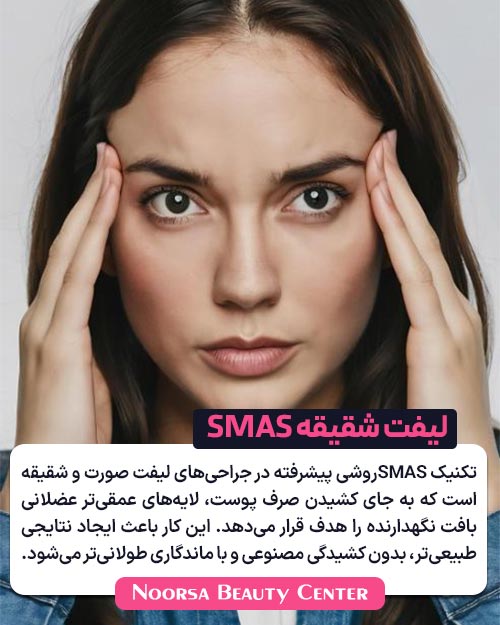 لیفت شقیقه با تکنیک SMAS