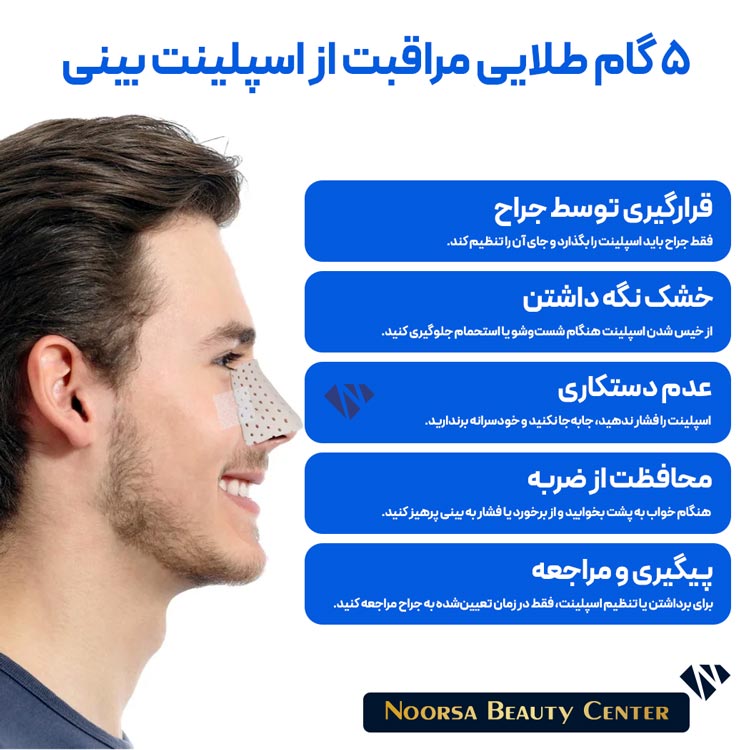 مراقبت های اسپلینت بینی