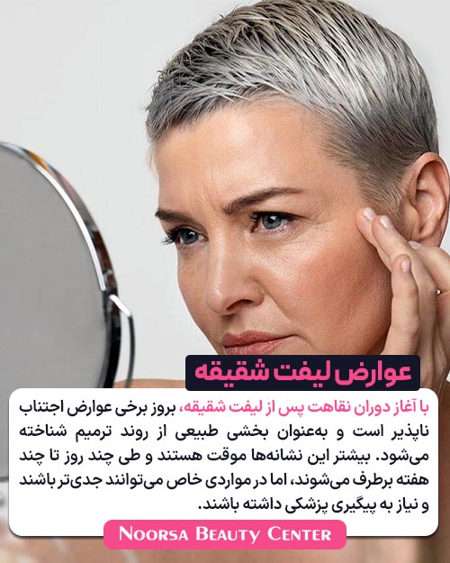 عوارض لیفت شقیقه